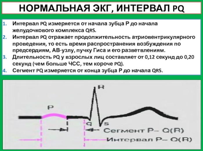 EKG kompleks QRS: norma, takikardia, yang mencerminkan qrs sempit, lebar, durasi