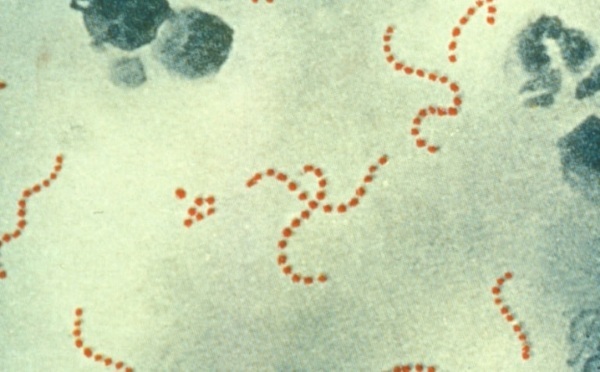 Streptococci (streptococcus spp) in a smear in women. Treatment, norm