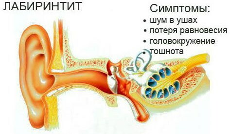 Schwindel und Tinnitus. Ursachen bei Frauen, Männern