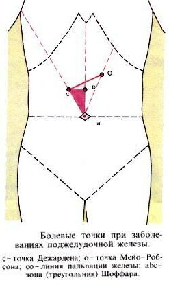 Tegn på betændelse i bugspytkirtlen hos en kvinde