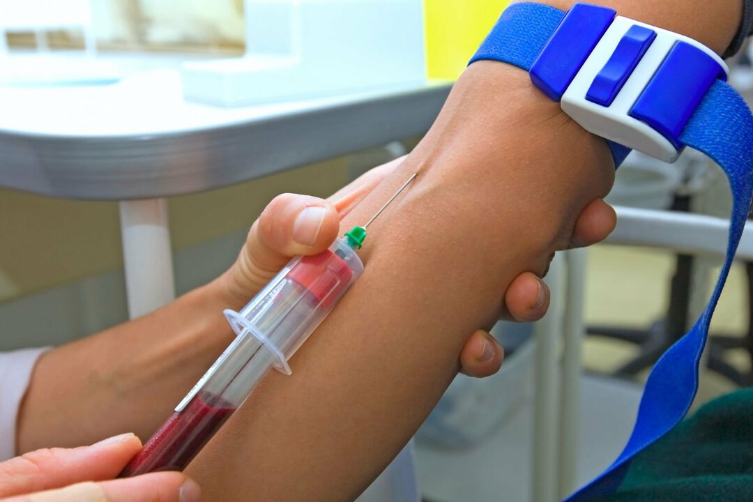 Test de sânge pentru tuberculoză: necesitatea unui test, pregătire și caracteristici de performanță, indicatori