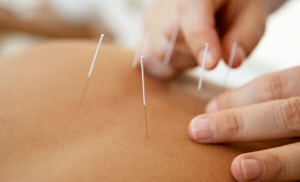 Acupuncture. Indications and contraindications
