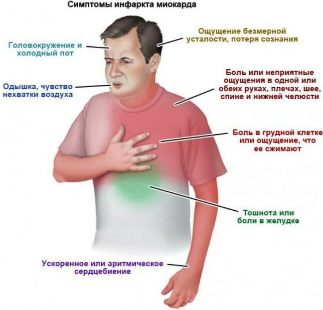 Miokarda infarkts: ko darīt, pirmā palīdzība