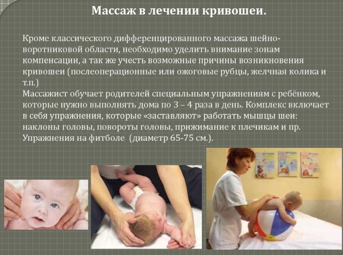 Tortícolis en bebés. Síntomas, fotos, tratamiento 2-3-4-6 meses.