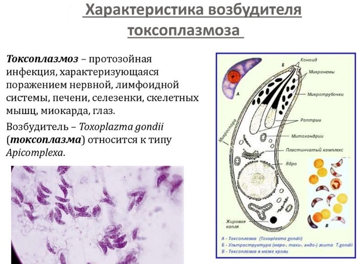 Toxoplasmosis in women. Symptoms and Treatment