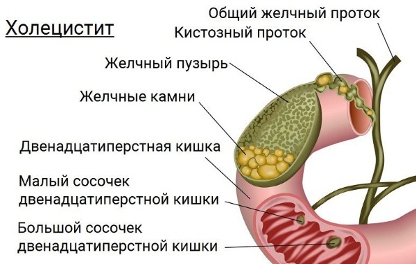 The gallbladder in humans. Where is located, photos, functions