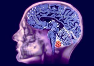 Vaskulær genese av hjernen: hva er det, symptomer og behandling