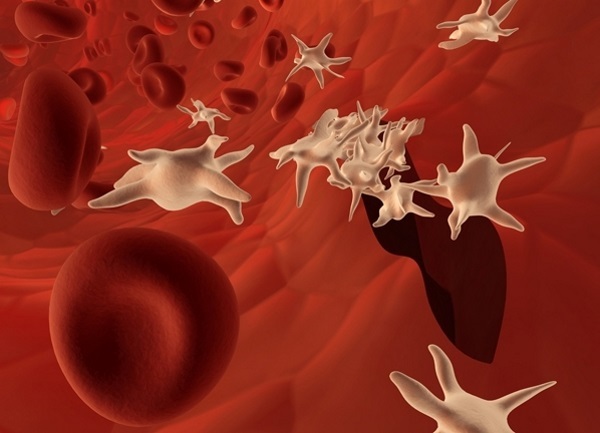 Kadınların kanda yükselmiş trombosit. Nedenleri ve ne anlama geldiğini tedavisi