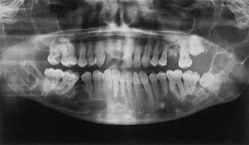 O imagine panoramică a dinților