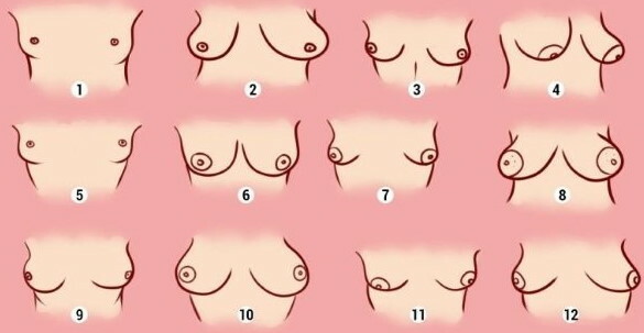 Nipples in women. Types of areolas, what are the forms