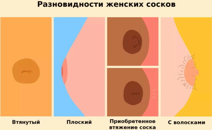 Nipples in women. Types of areolas, what are the forms