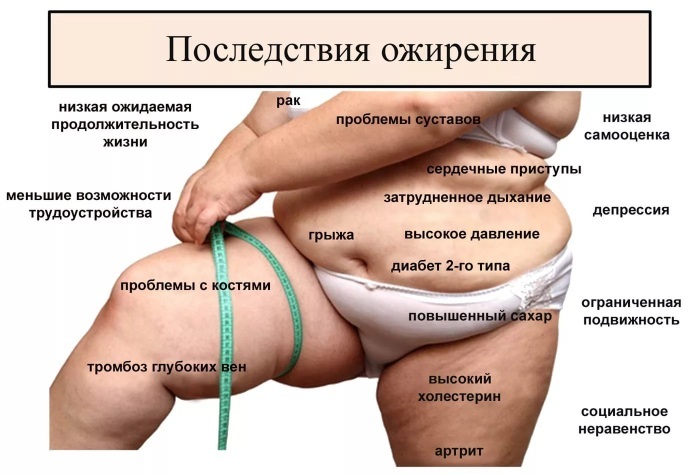 Tabuľka obezity pre ženy podľa hmotnosti, výšky, veku. Stupne