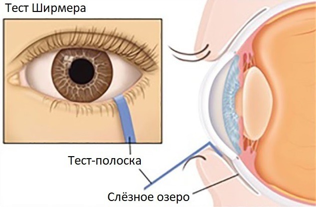 Schirmers test i oftalmologi. Vad är det, hur man bedriver, normer