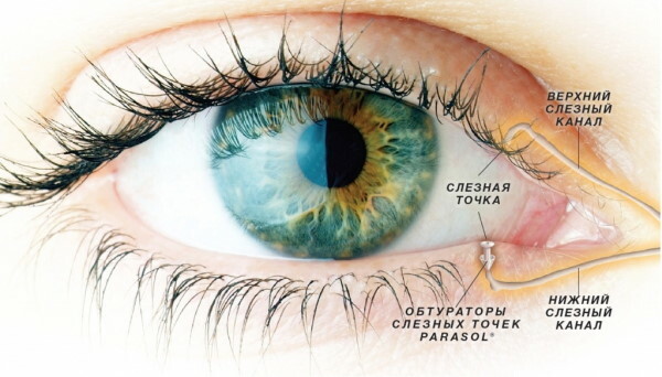 Syndrom suchého oka. Léčba, kapky, léky, laser
