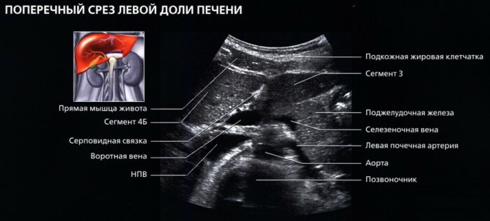 Leversegmenter på ultralyd, CT, MR -sektioner: diagram, foto