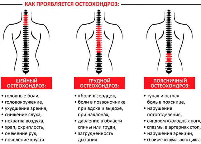 Temperatura osteochondrozy odcinka szyjnego, lędźwiowego, piersiowego kręgosłupa