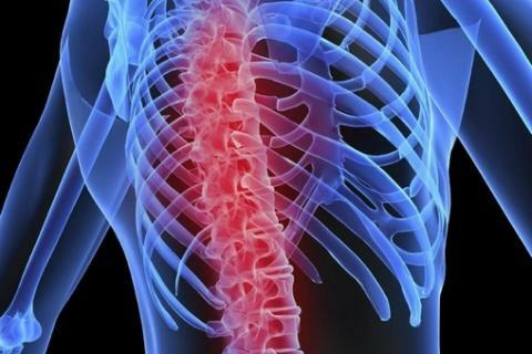 Spondyl significa la columna vertebral y osis - trastornos