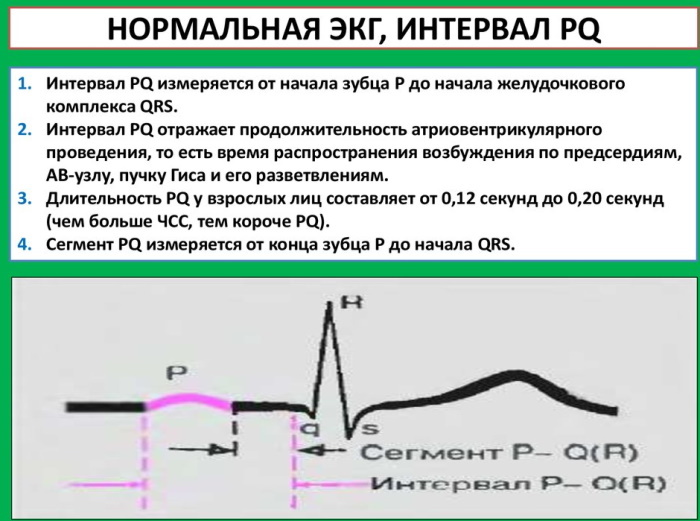 So lesen Sie das Elektrokardiogramm des Herzens selbst. EKG-Dekodierung