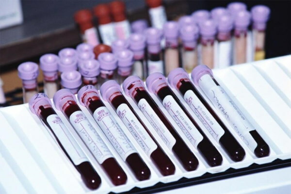 Typy krevních testů: co jsou, názvy