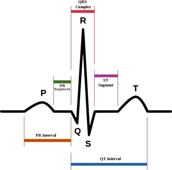 EKG'de PQ kısalması. Bu ne demek