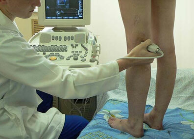 Ultrazvuk nohy