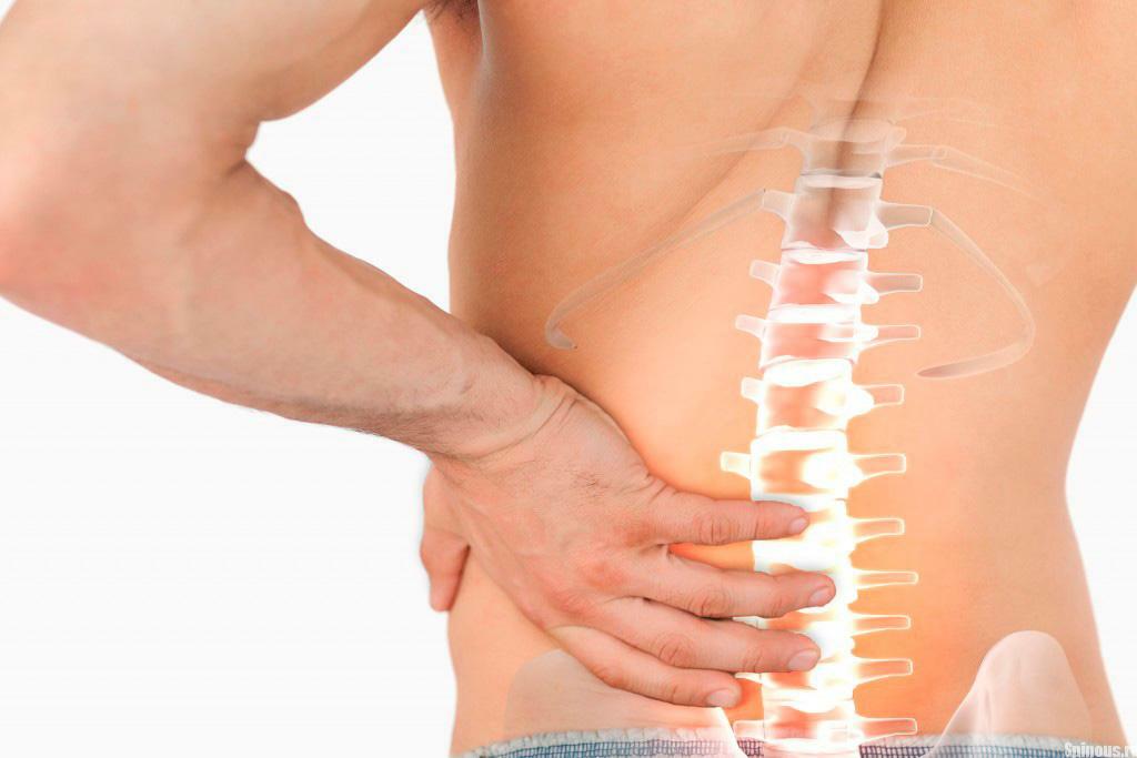 Stenoza coloanei vertebrale lombare - simptome și tratamente eficiente