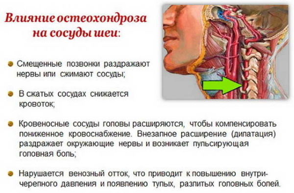 L'emisfero destro della testa, la parte posteriore della testa, la tempia fanno male. Cause e trattamento
