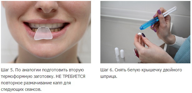 Zobu balināšana mājās ar mutes aizsargiem. Atsauksmes, cena