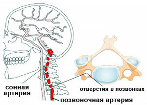 creierul arterelor