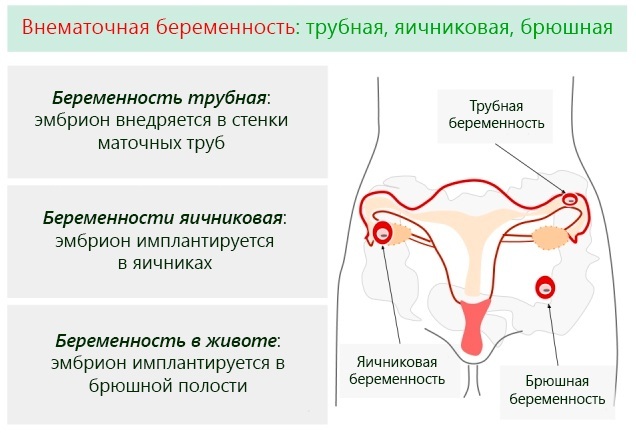 Bioquímica del suero materno en el trimestre 1-2-3. Descodificación