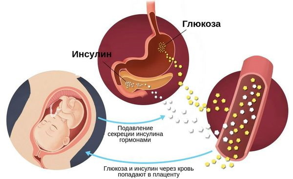 Suurenenud vere glükoosisisaldus raseduse ajal