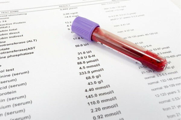 MID la testul de sânge este crescut la un copil, femei, bărbați