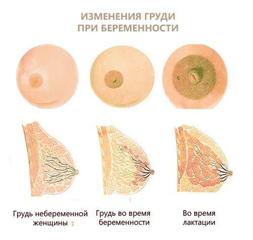 Aumento de senos durante el embarazo