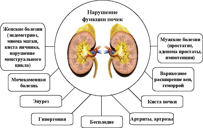 Treatment of the kidneys with folk remedies. The most effective remedies