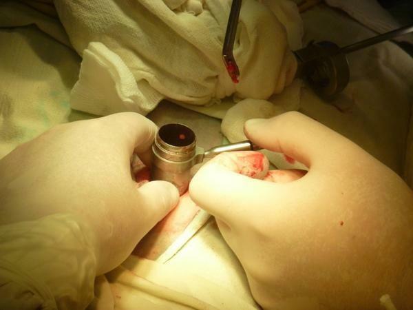 Lomber omurga ameliyatına hazırlık
