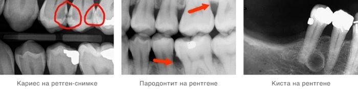 Radiografia dei denti. Scatto panoramico, come si fa durante la gravidanza, che mostra il prezzo