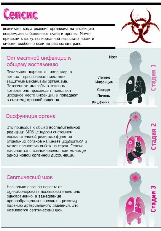 Staphylococcus aureus (staphylococcus aureus): norma w rozmazie z gardła, od 10 do 3-8 stopni