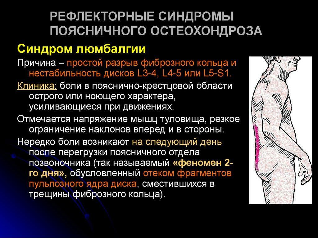 Síntomas de la osteocondrosis lumbar
