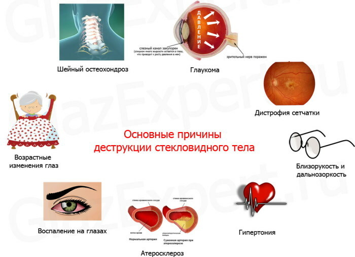 Oko-Plus-Augentropfen. Gebrauchsanweisung, Preis, Bewertungen