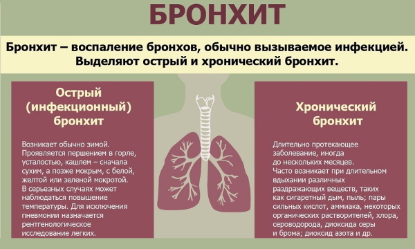 Keuhkoputkien tulehdus. Oireet aikuisilla ilman kuumetta ja sen kanssa, hoito
