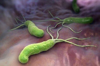 Midede Helicobacter pylori bakteri: semptomlar, tedavi