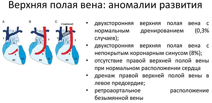 Augstākā vena cava. Anatomija, topogrāfija, izmēri, kā tā veidojas, kāds asinsrites aplis, pietekas, shēma